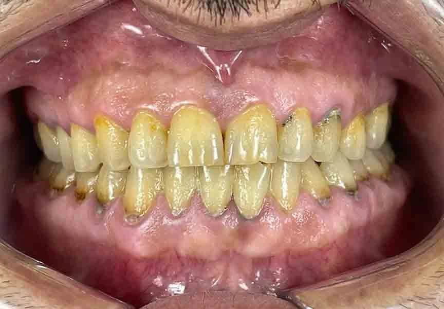 Alp's Dental