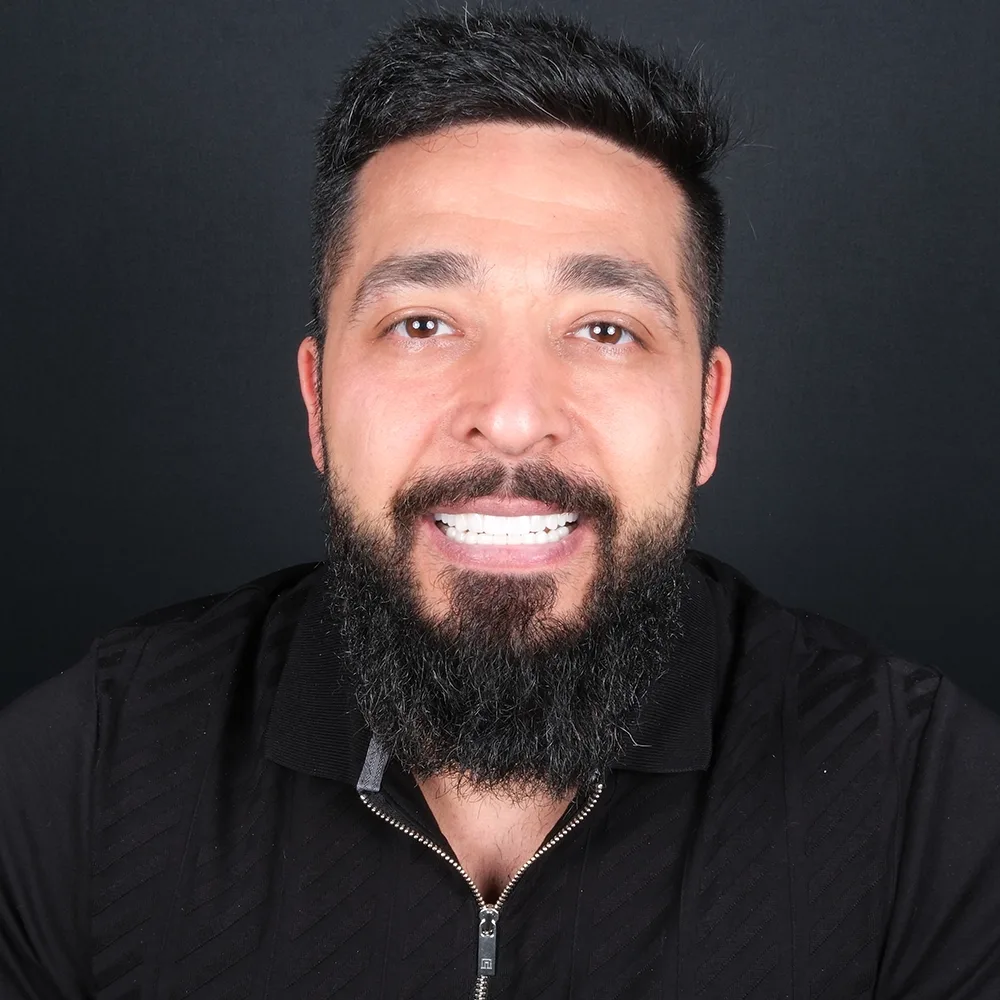 Laminate veneers result
