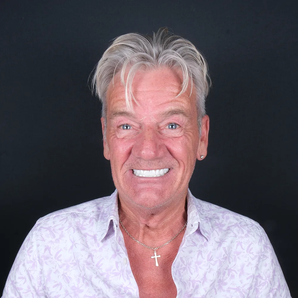 Dental implants result