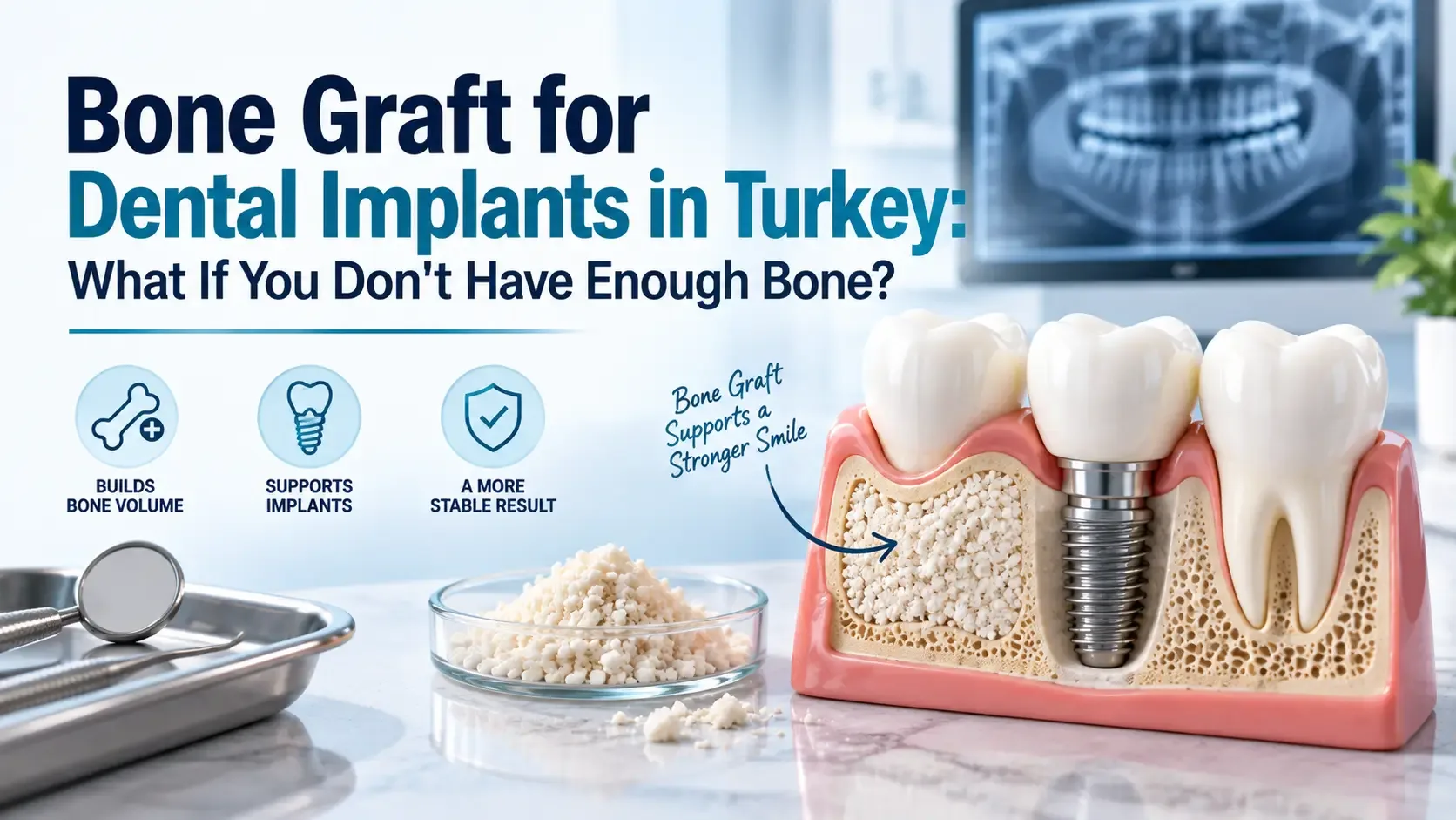 Bone Graft for Dental Implants in Turkey